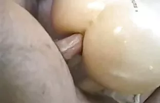 XXX Iveta ginecomastia e exame do espéculo filme de pornô de graça anal